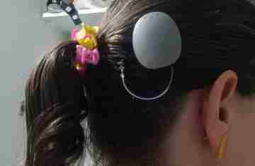 Paraná assume liderança nacional em implantes de correção auditiva pelo SUS